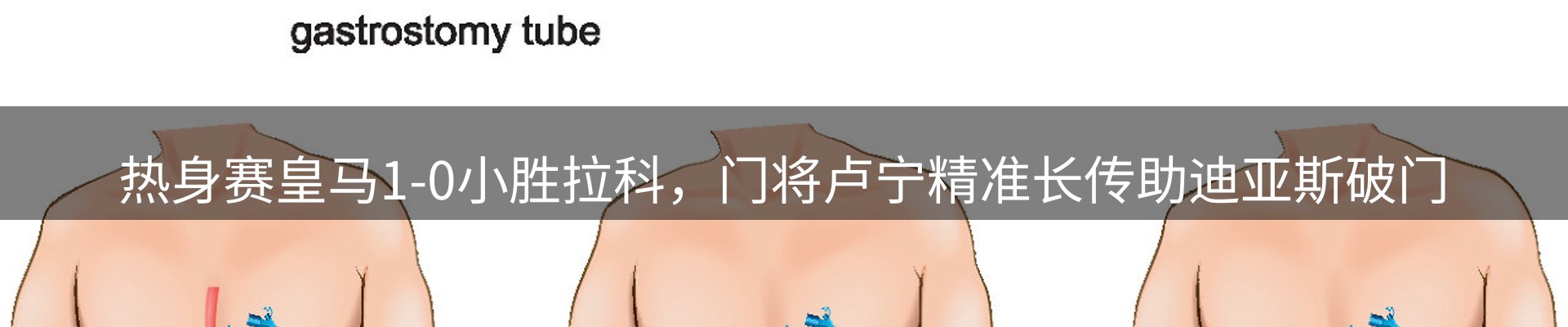 平台简报